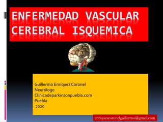 ENFERMEDAD VASCULAR
CEREBRAL ISQUEMICA
Guillermo Enríquez Coronel
Neurólogo
Clinicadeparkinsonpuebla.com
Puebla
2020
enriquezcoronelguillermo@gmail.com
 