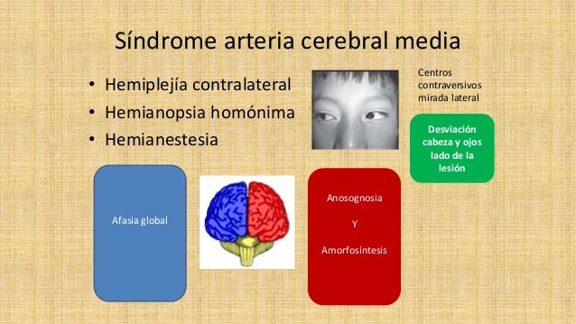 Enfermedad vascular cerebral