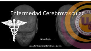 Enfermedad Cerebrovascular 
Neurología 
Jennifer Xiomara Hernández Davila 
 