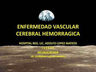 ENFERMEDAD VASCULAR
CEREBRAL HEMORRAGICA
HOSPITAL REG. LIC. ADOLFO LOPEZ MATEOS
I S S S T E
NEUROCIRUGIA
DR. LEONARDO CASTILLO MENDEZ
 