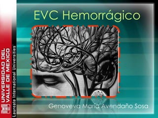 EVC Hemorrágico

Genoveva María Avendaño Sosa

 