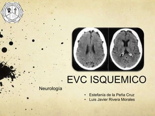 EVC ISQUEMICO
Neurología
• Estefanía de la Peña Cruz
• Luis Javier Rivera Morales
 