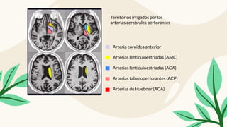Arteria coroidea anterior
Arterias lenticuloestriadas (AMC)
Arterias lenticuloestriadas (ACA)
Arterias talamoperforantes (ACP)
Arterias de Huebner (ACA)
Territorios irrigados por las
arterias cerebrales perforantes
 
