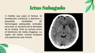 Ictus Subagudo
A medida que pasa el tiempo, la
tumefacción comienza a disminuir y
pequeñas cantidades de
hemorragias petequiales corticales
provocan un aumento de la densidad
de la corteza. Esto se conoce como
el fenómeno de niebla (fogging). La
región del infarto cortical recupera
una apariencia casi normal.
 
