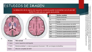 ESTUDIOS DE IMAGEN
La detección de lo signos de isquemia cerebral puede incrementar con el uso del
ASPECTS (útil sólo en región de la ACM)
C Núcleo caudado
L Núcleo lenticular
CI Cápsula interna
I Insula
M1 Territorio anteroinferior de ACM
M2 Territorio inferiomedial de ACM
M3 Territorio inferoposterior de ACM
M4 Territorio supeeroanterior de ACM
M5 Territorio superomedial de ACM
M6 Territorio superoinferior de ACM
10 ptos TAC normal
>7 ptos Lesion isquemica restringuida
<7 ptos Morbimortalidad ↑ y mala recuperacion funcional. ↑ HIC con terapia trombolítica
0 ptos Afección completa de ACM
•Diagnósticoytratamientotempranodelaenfermedadvascularcerebralisquémicaenel
segundoytercerniveldeatención.SecretaríadeSalud,CiudaddeMéxico,16/03/2017.
Disponibleen:http://imss.gob.mx/profesionales-salud/gpc
http://www.cenetec.salud.gob.mx/contenidos/gpc/catalogoMaestroGPC.html
 