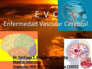E V C
Enfermedad Vascular Cerebral.
Dr. Santiago T. Bojórquez Camacho
Médico Internista
Urgencias HGR N°1- Med. Interna CIDOCS
 