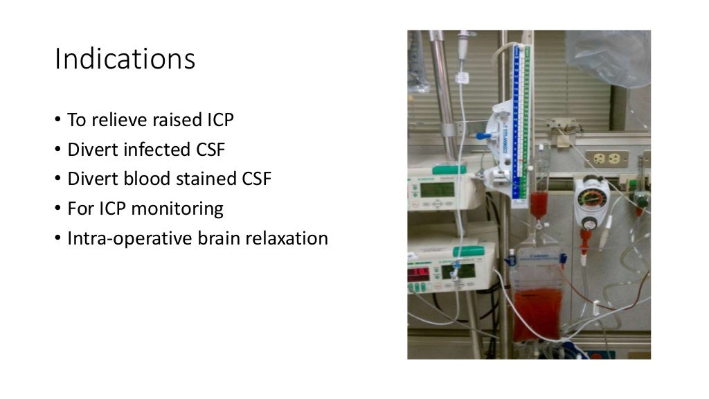 External Ventricular Drain (EVD)