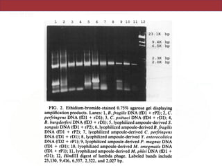 1 2 3 4 5 6 7 8 9 10 11 12
FIG. 2. Ethidium-bromide-stained 0.75% agarose
amplification products. Lanes: 1, B. fragilis DNA (fD1
perfringens DNA (fD1 + rD1); 3, C. psittaci DNA (fi
B. burgdorferi DNA (fD3 + rD1); 5, lyophilized ampou
sanguis DNA (fD1 + rP2); 6, lyophilized ampoule-deriN
DNA (ff1 + rP2); 7, lyophilized ampoule-derived C
DNA (ff1 + rD1); 8, lyophilized ampoule-derived Y.
DNA (fD2 + rPl); 9, lyophilized ampoule-derived P. A
(fD1 + rD1); 10, lyophilized ampoule-derived M. sine
(fD1 + rP1); 11, lyophilized ampoule-derived M. phlie
rD1); 12, Hindlll digest of lambda phage. Labeled b
23,130, 9,416, 6,557, 2,322, and 2,027 bp.
were amplified wi
Streptococcus sang
23 1K bp ATCC 25285 (fD1
13124 (fD1 + rDl
9
K5 bp 29328 (fD1 + rDl),
+ rPl), Mycobacte
2 .3K bp rPl), and Mycobact
2. OK bp The last four specie
forward primer sim
that of fDl, but the
sequence (see disc
that Y. enterocolit
that, under the righ
reverse primers may
rDNAs. A similar
with Campylobacter
gel displaying The lyophilized
4 +rP2); 2,C. expiration date 8 m
I4 -derivd S. ods even simpler th
ved B fragilis beating method we
'.perfringens ampoules. The sim
enterocolitica lyophilized ampoule
nagnus DNA containing 0.45%
ggmatis DNA detergents. This sa
DNA (fD1 + used to prime an a
)ands include ful, this method wa
cause it is not likely
VOL. 173, 1991
 
