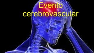 Evento
cerebrovascular
 