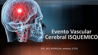 Evento Vascular
Cerebral ISQUEMICO
EVC, ACV, APOPLEJIA, embolia, ICTUS
 