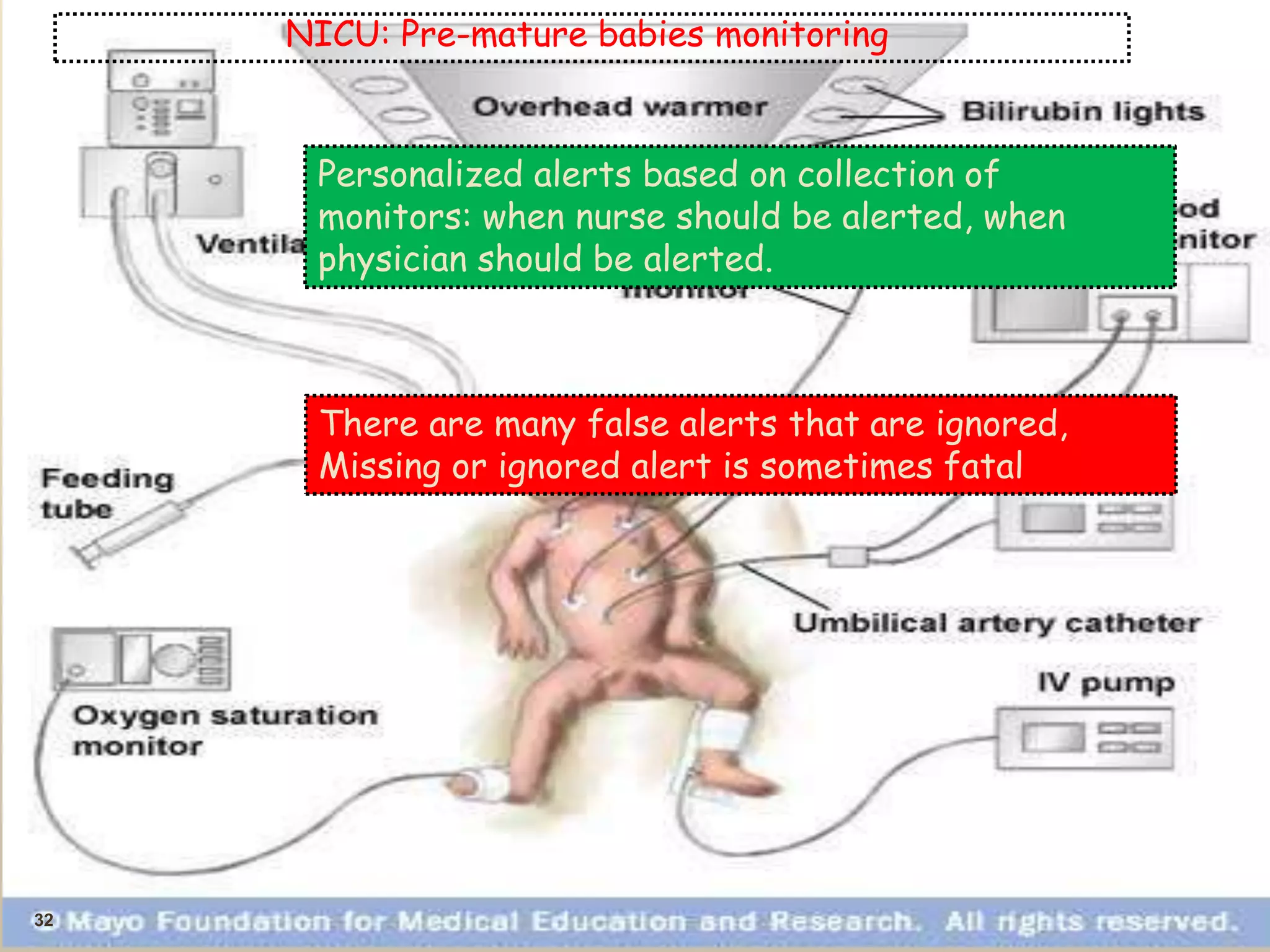 32
NICU: Pre-mature babies monitoring
Personalized alerts based on collection of
monitors: when nurse should be alerted, when
physician should be alerted.
There are many false alerts that are ignored,
Missing or ignored alert is sometimes fatal
 