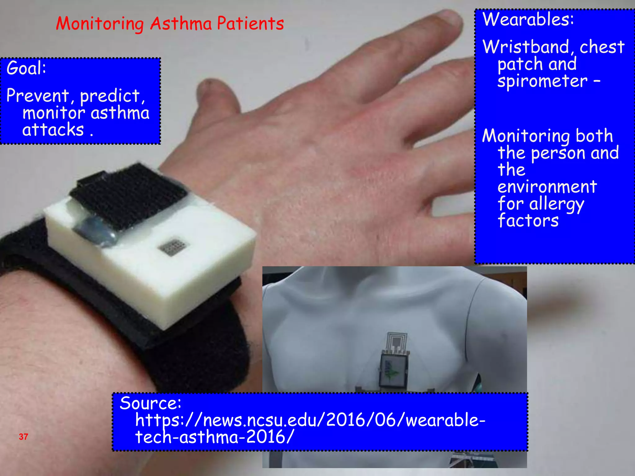 37
Wearables:
Wristband, chest
patch and
spirometer –
Monitoring both
the person and
the
environment
for allergy
factors
Goal:
Prevent, predict,
monitor asthma
attacks .
Monitoring Asthma Patients
Source:
https://news.ncsu.edu/2016/06/wearable-
tech-asthma-2016/
 