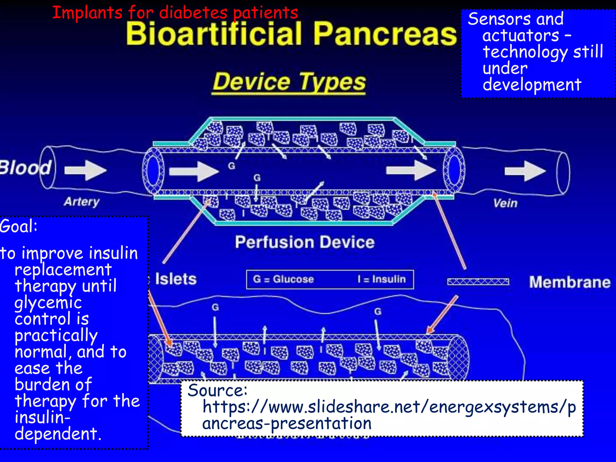 38
Sensors and
actuators –
technology still
under
development
Goal:
to improve insulin
replacement
therapy until
glycemic
control is
practically
normal, and to
ease the
burden of
therapy for the
insulin-
dependent.
Implants for diabetes patients
Source:
https://www.slideshare.net/energexsystems/p
ancreas-presentation
 
