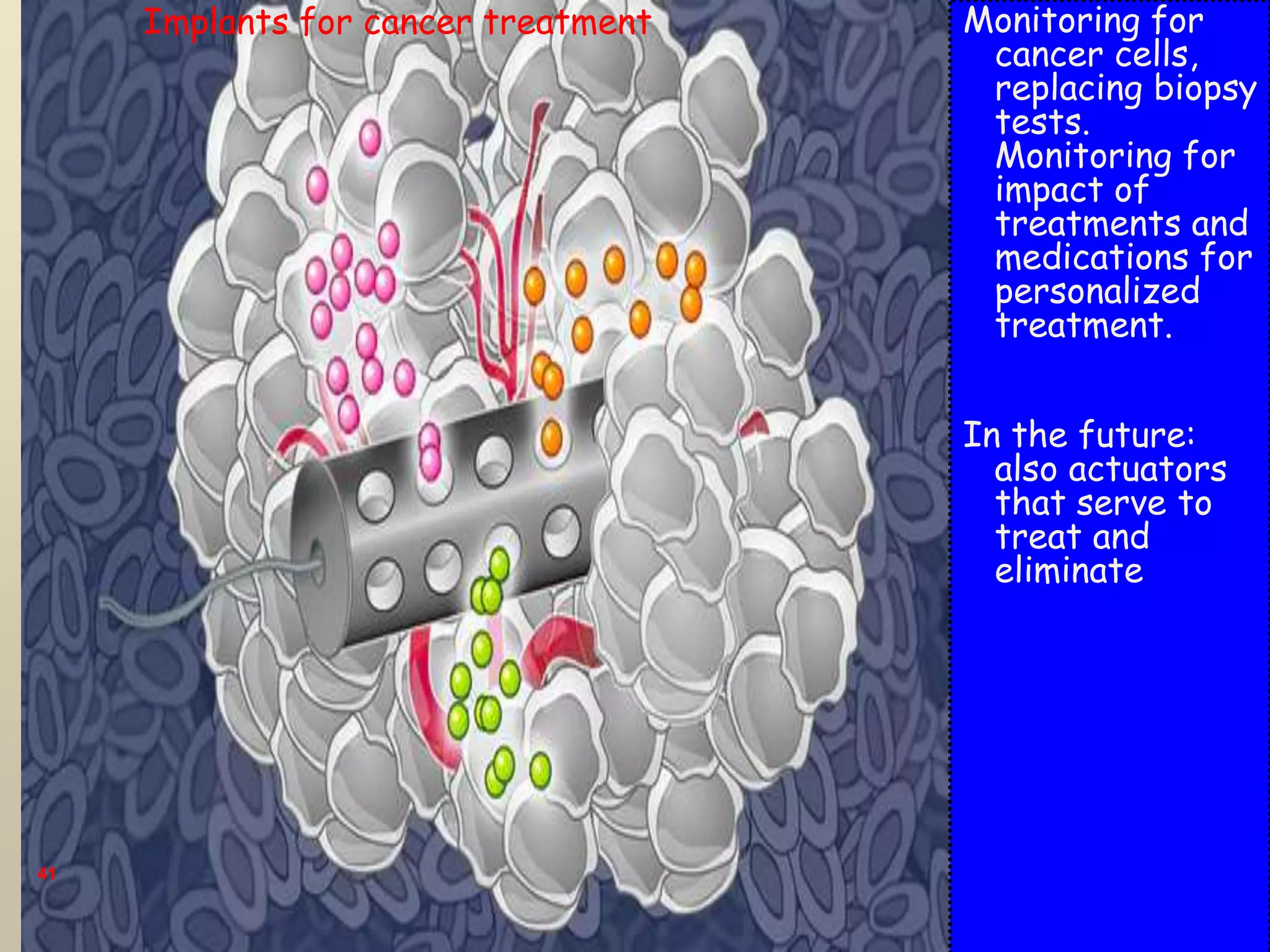 41
Monitoring for
cancer cells,
replacing biopsy
tests.
Monitoring for
impact of
treatments and
medications for
personalized
treatment.
In the future:
also actuators
that serve to
treat and
eliminate
Implants for cancer treatment
 