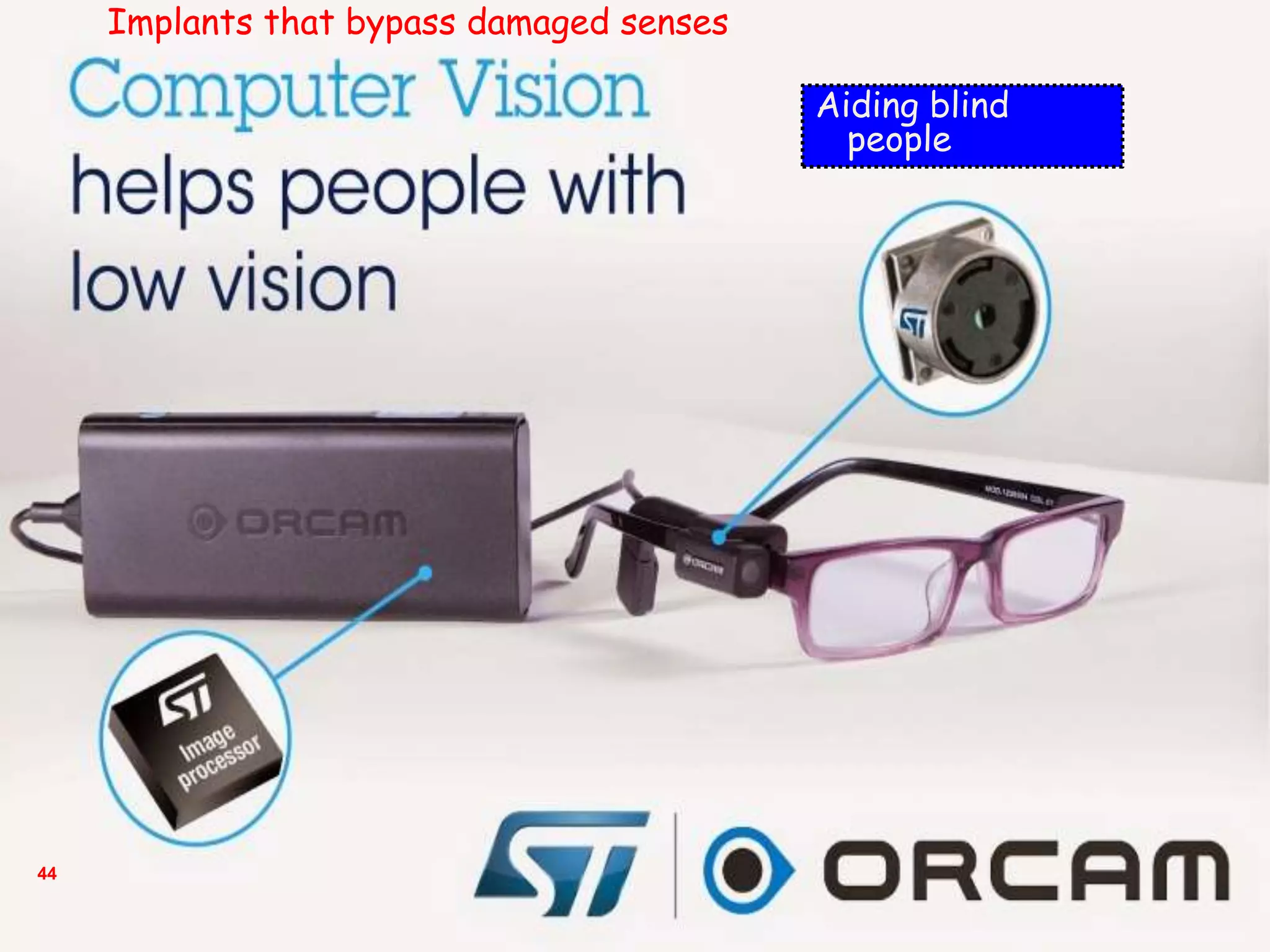 44
Aiding blind
people
Implants that bypass damaged senses
 