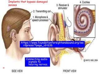 43
Connecting audio
signals to
hearing nerves.
Implants that bypass damaged
senses
https://www.foundationforsightandsound.org/wo
rdpress/?page_id=636
 