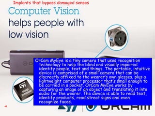 45
OrCam MyEye is a tiny camera that uses recognition
technology to help the blind and visually impaired
identify people, text and things. The portable, intuitive
device is comprised of a small camera that can be
discreetly affixed to the wearer’s own glasses, plus a
lightweight computer processor that’s small enough to
be carried in a pocket. OrCam MyEye works by
capturing an image of an object and translating it into
audio for the wearer. The device is able to read text,
identify products, read street signs and even
recognize faces.
Implants that bypass damaged senses
 