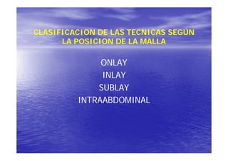 Sublay Only Eventracion | PDF
