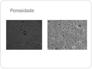 Porosidade

 