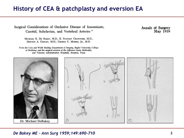 carotid endarterectomy anesthesia