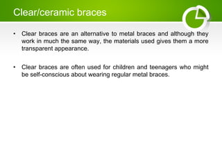 Everything You Need To Know About Braces | PPT