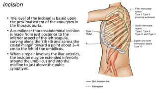 Taaa Incision SURGICAL MANAGEMENT of thoracic abdominal aortic aneurysms.pptx