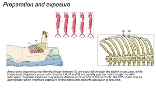 SURGICAL MANAGEMENT of thoracic abdominal aortic aneurysms.pptx