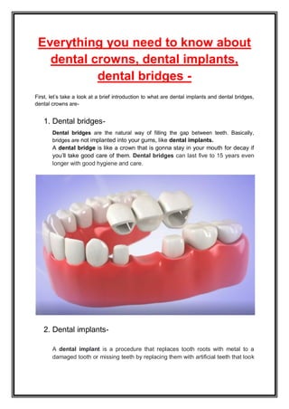 Everything you need to know about
dental crowns, dental implants,
dental bridges -
First, let’s take a look at a brief introduction to what are dental implants and dental bridges,
dental crowns are-
1. Dental bridges-
Dental bridges are the natural way of filling the gap between teeth. Basically,
bridges are not implanted into your gums, like dental implants.
A dental bridge is like a crown that is gonna stay in your mouth for decay if
you’ll take good care of them. Dental bridges can last five to 15 years even
longer with good hygiene and care.
2. Dental implants-
A dental implant is a procedure that replaces tooth roots with metal to a
damaged tooth or missing teeth by replacing them with artificial teeth that look
 