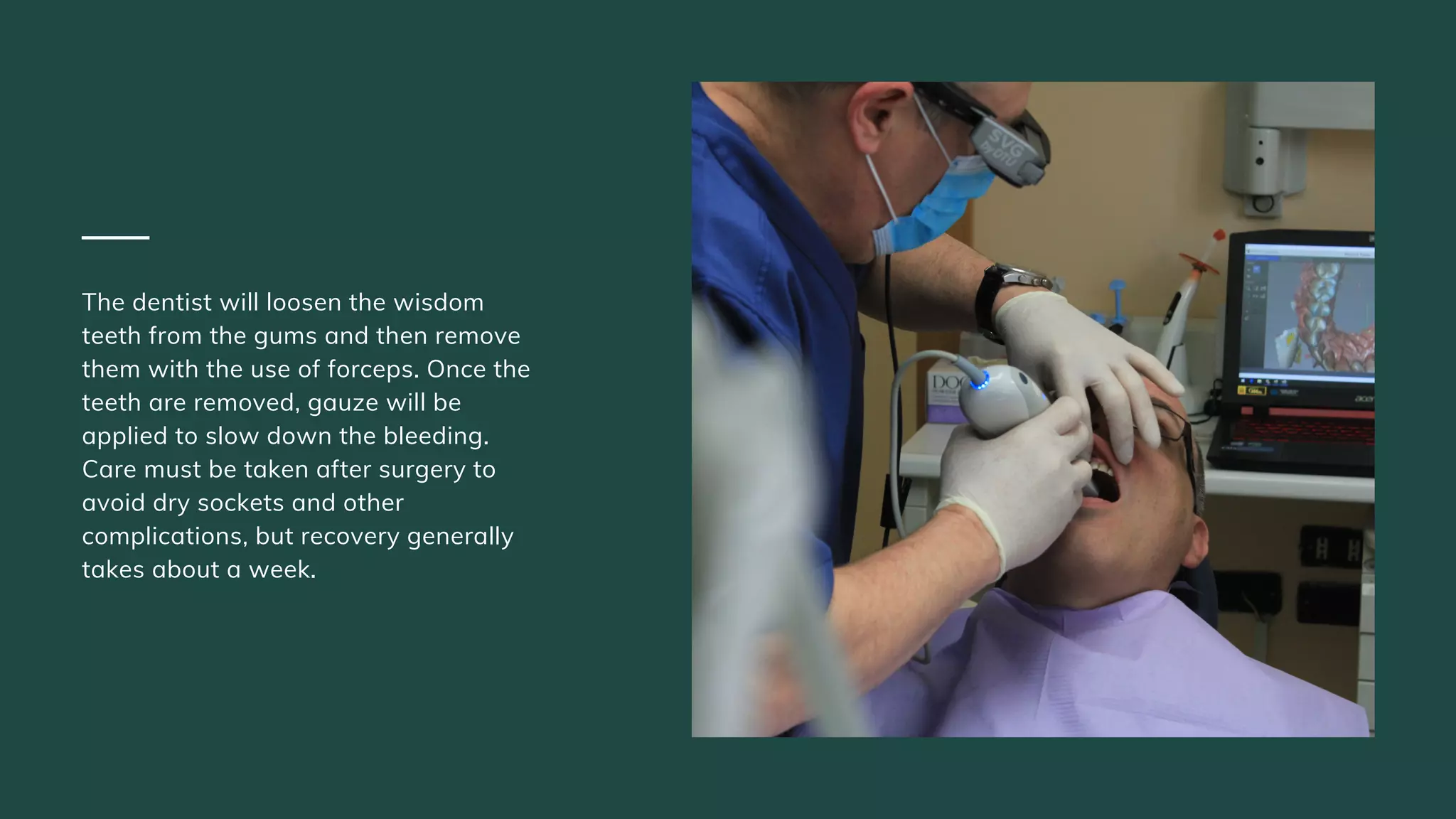 Everything You Need To Know About Wisdom Teeth Removal | PDF