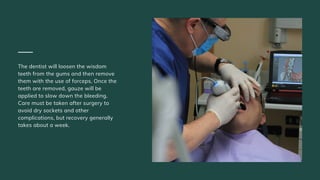 The dentist will loosen the wisdom
teeth from the gums and then remove
them with the use of forceps. Once the
teeth are removed, gauze will be
applied to slow down the bleeding.
Care must be taken after surgery to
avoid dry sockets and other
complications, but recovery generally
takes about a week.
 