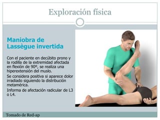 Dolor AgudoEn dolor leve.la primera opción es paracetamol. Cuando el dolor es moderadoLos AINE solos o asociados a opioides menores son eficacesLa asociación de paracetamol con opioides menores es una alternativa válida. La utilización combinada de analgésicos con distinto mecanismo de acción consigue mejor eficacia analgésica con menos toxicidad. No deberían asociarse dos AINE, por la mayor frecuencia de aparición de efectos adversos. Cuando el dolor es intenso.La mayor eficacia analgésica se consigue con opioides potentes. El escalonamiento analgésico prolonga el sufrimiento del pacienteEVES- 201153