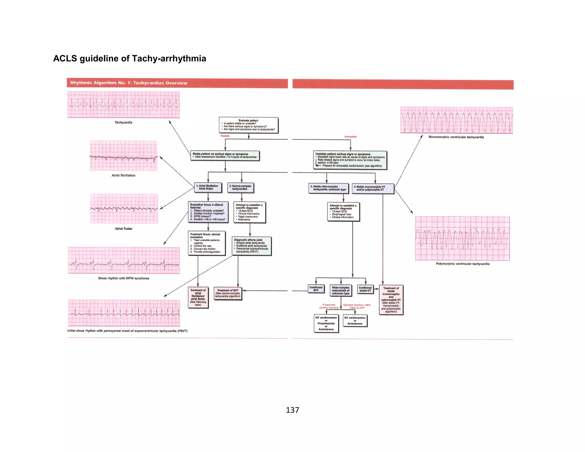 137
ACLS guideline of Tachy-arrhythmia
 
