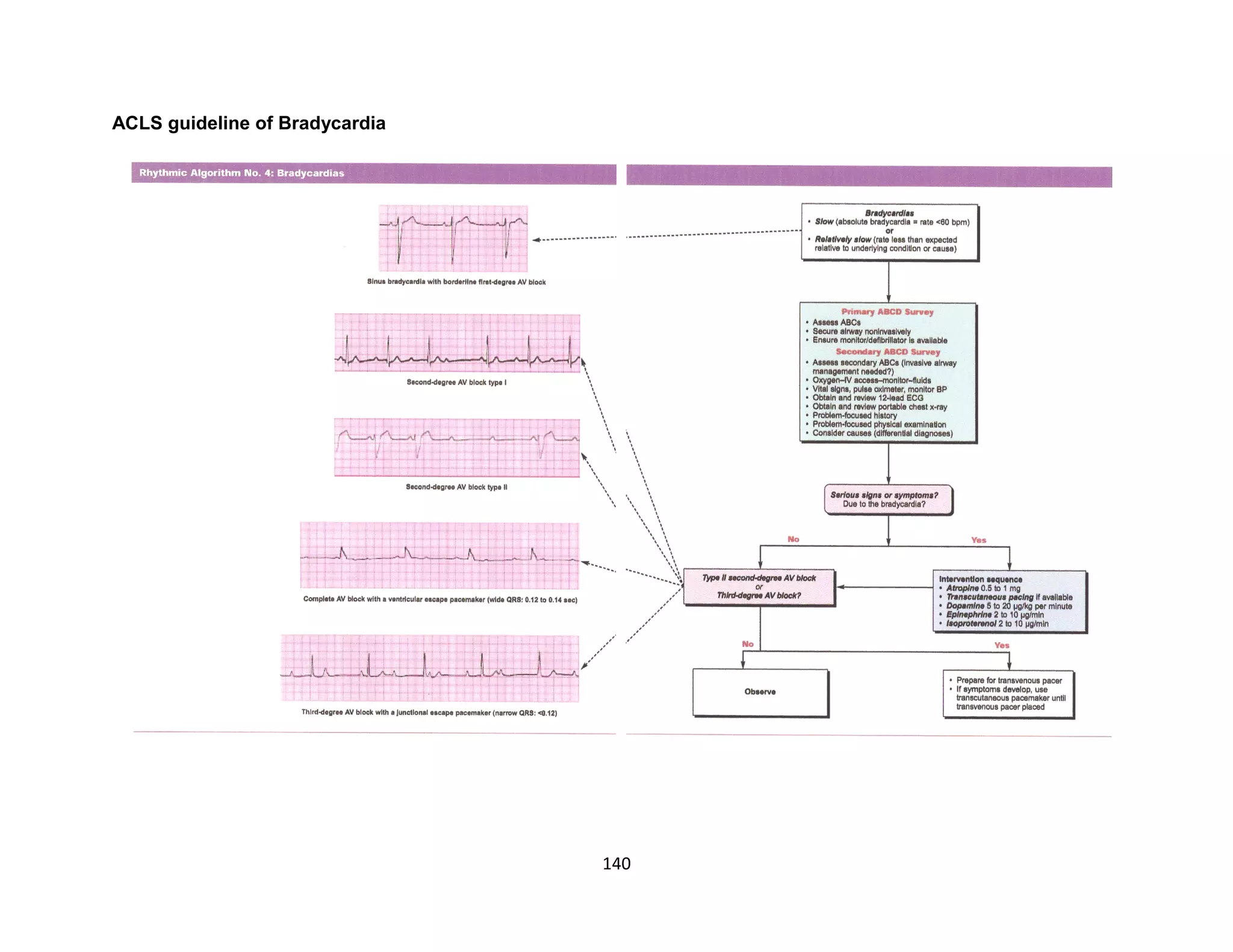 140
ACLS guideline of Bradycardia
 