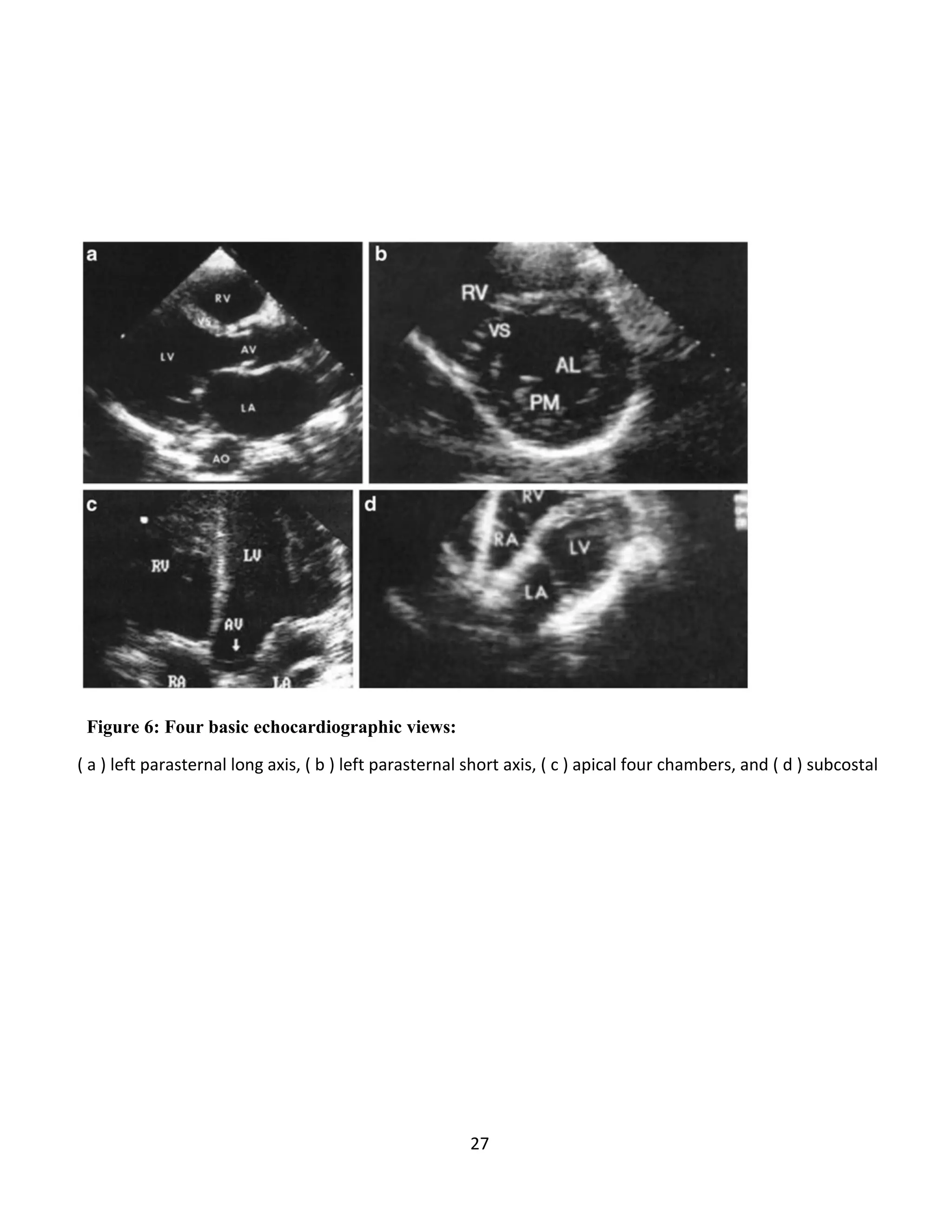 27
Figure 6: Four basic echocardiographic views:
( a ) left parasternal long axis, ( b ) left parasternal short axis, ( c ) apical four chambers, and ( d ) subcostal
 