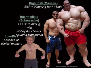 High Risk (Massive)
SBP < 90mmHg for > 15min
Intermediate
(Submassive)
SBP > 90mmHg
with
RV dysfunction or
elevated biomarkersLow-Risk
absence of
clinical markers
Jaff MR. Circulation. 2011;123:1788-1830
 
