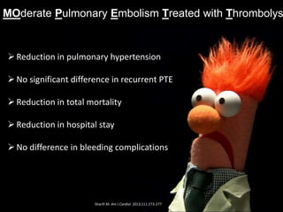 MOderate Pulmonary Embolism Treated with Thrombolys
Sharifi M. Am J Cardiol. 2013;111:273-277
Reduction in pulmonary hypertension
No significant difference in recurrent PTE
Reduction in total mortality
Reduction in hospital stay
No difference in bleeding complications
 