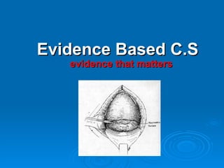 Evidence Based C.S evidence that matters 