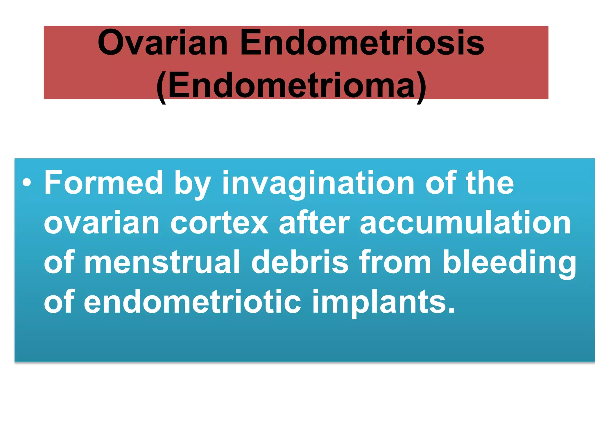 Ovarian Endometriosis
(Endometrioma)
• Formed by invagination of the
ovarian cortex after accumulation
of menstrual debris from bleeding
of endometriotic implants.
 