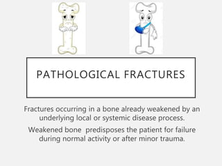 Bone tumor and Pathological fractures seminar and evidence based medicine