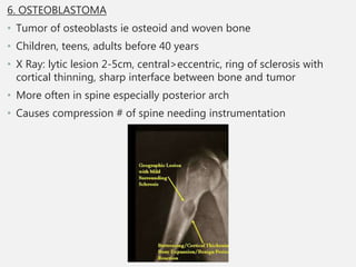 Bone tumor and Pathological fractures seminar and evidence based medicine