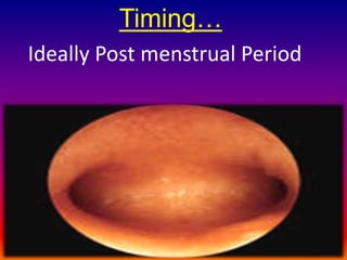 Timing… 
Ideally Post menstrual Period 
27-Nov-14 Dr Shashwat Jani. 9909944160 13 
 