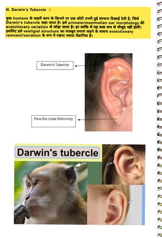 N. Darwin's Tubercle
<br>
Darwin's tubercle hEI GIlGI Ià primate/mammalian ear morphology r
<br>
Fefa t vestigial structure Hg HTOT
HF aSITU evolutionary
<br>
Darwin's Tubercle
<br>
Pixie Ear Lobe Deformity
<br>
Darwin's tubercle
<br>
 
