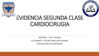 EVIDENCIA SEGUNDA CLASE
CARDIOCIRUGIA
DOCENTE : LIDY HIGUERA
ESTUDIANTE: LUCERO CABALLERO ARENAS
UNIVERDIDAD DE SANTANDER
 