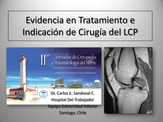 Evidencia en Tratamiento e Indicación de Cirugía del LCP Dr. Carlos E. Sandoval C. Hospital Del Trabajador Equipo Extremidad Inferior Santiago, Chile 