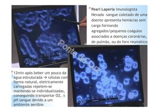 *Pearl Laperla imunologista
Nevada –sangue coletado de uma
doente apresenta hemácias sem
carga formando
agregados/pequenos coágulos
associados a doenças coronárias,
de pulmão, ou do foro reumático
*12min após beber um pouco da
água estruturada células com
forma natural, eletricamente
carregadas repelem-se
mantendo-se individualizadas,
conseguindo transportar O2, ∆
pH sangue devido a um
ambiente aeróbio
 