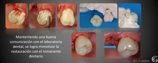 Manteniendo una buena
comunicación con el laboratorio
  dental, se logra mimetizar la
 restauración con el remanente
            dentario
                                  Técn. J.C. Sebático
 