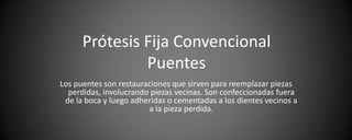 Prótesis Fija Convencional
               Puentes
Los puentes son restauraciones que sirven para reemplazar piezas
  perdidas, involucrando piezas vecinas. Son confeccionadas fuera
 de la boca y luego adheridas o cementadas a los dientes vecinos a
                        a la pieza perdida.
 