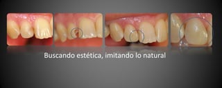 Buscando estética, imitando lo natural
 