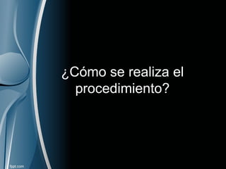 ¿Cómo se realiza el
procedimiento?
 