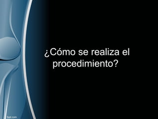 ¿Cómo se realiza el
procedimiento?
 